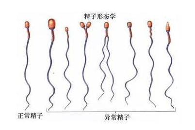 男的精子多长时间恢复