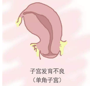 子宫小能怀孕吗