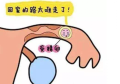 输卵管堵塞能治好吗