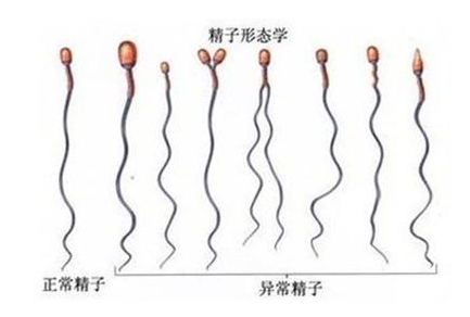 导致男性精液少的原因有哪些