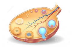 西安得了多囊卵巢综合征咋办？怎么治疗？